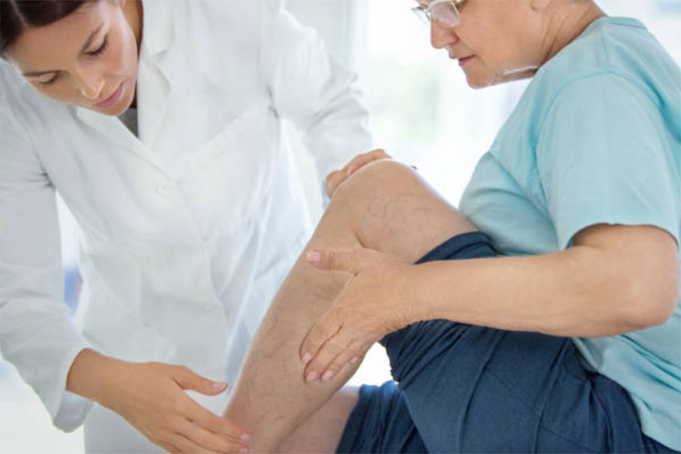 Chronic Venous Disease